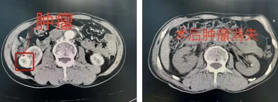 微信截图_20250911083812